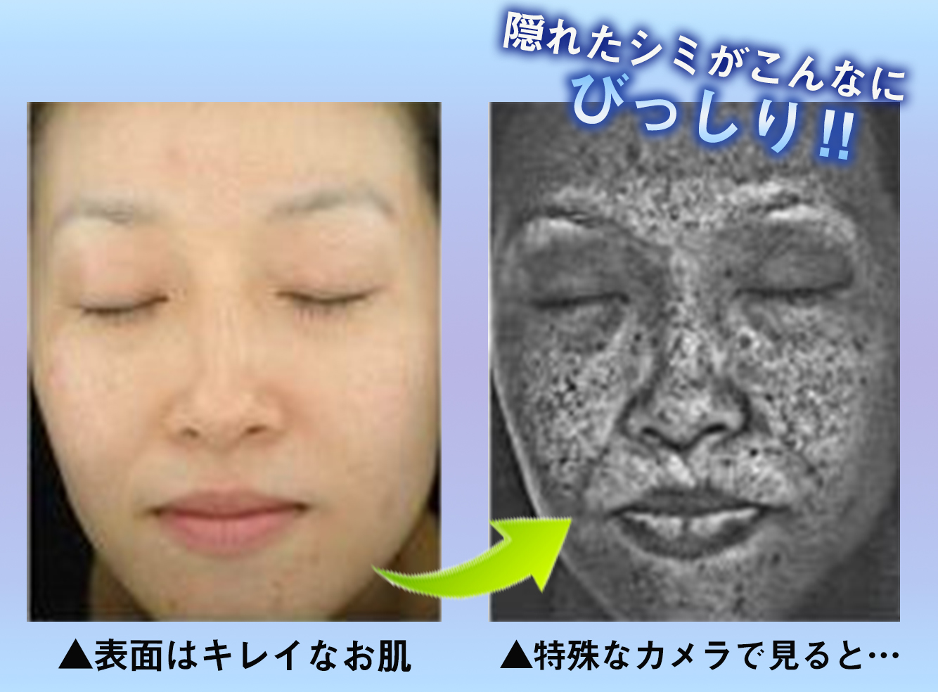 そうなんです ミユキ 46 は私と同い年なのにシミひとつ無い 25歳と間違えられるほどの美魔女 普